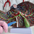 Should you Take Digestive Enzymes After Gallbladder Removal Surgery?